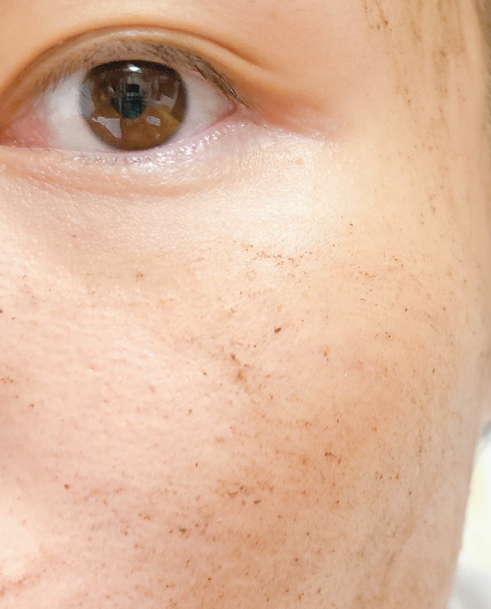 ダーマスキンピーリング/BQCELL/その他キットセットを使ったクチコミ(3枚目)