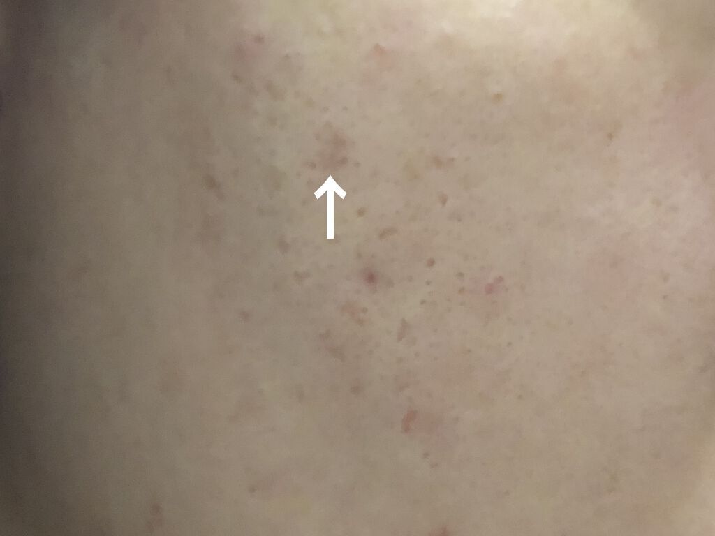 ロゼット洗顔パスタ ブラックパール/ロゼット/洗顔フォームを使ったクチコミ（2枚目）