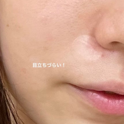 ポイントパッチ(集中ケアシート)/アクネスラボ/にきびパッチを使ったクチコミ(3枚目)