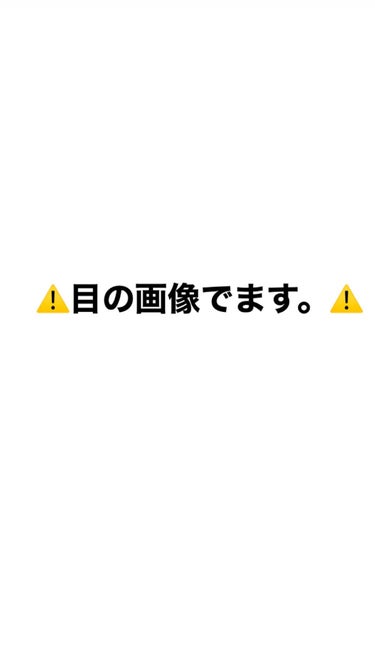 アイビューティー フィクサー WP/アストレア ヴィルゴ/二重まぶた用アイテムを使ったクチコミ（3枚目）