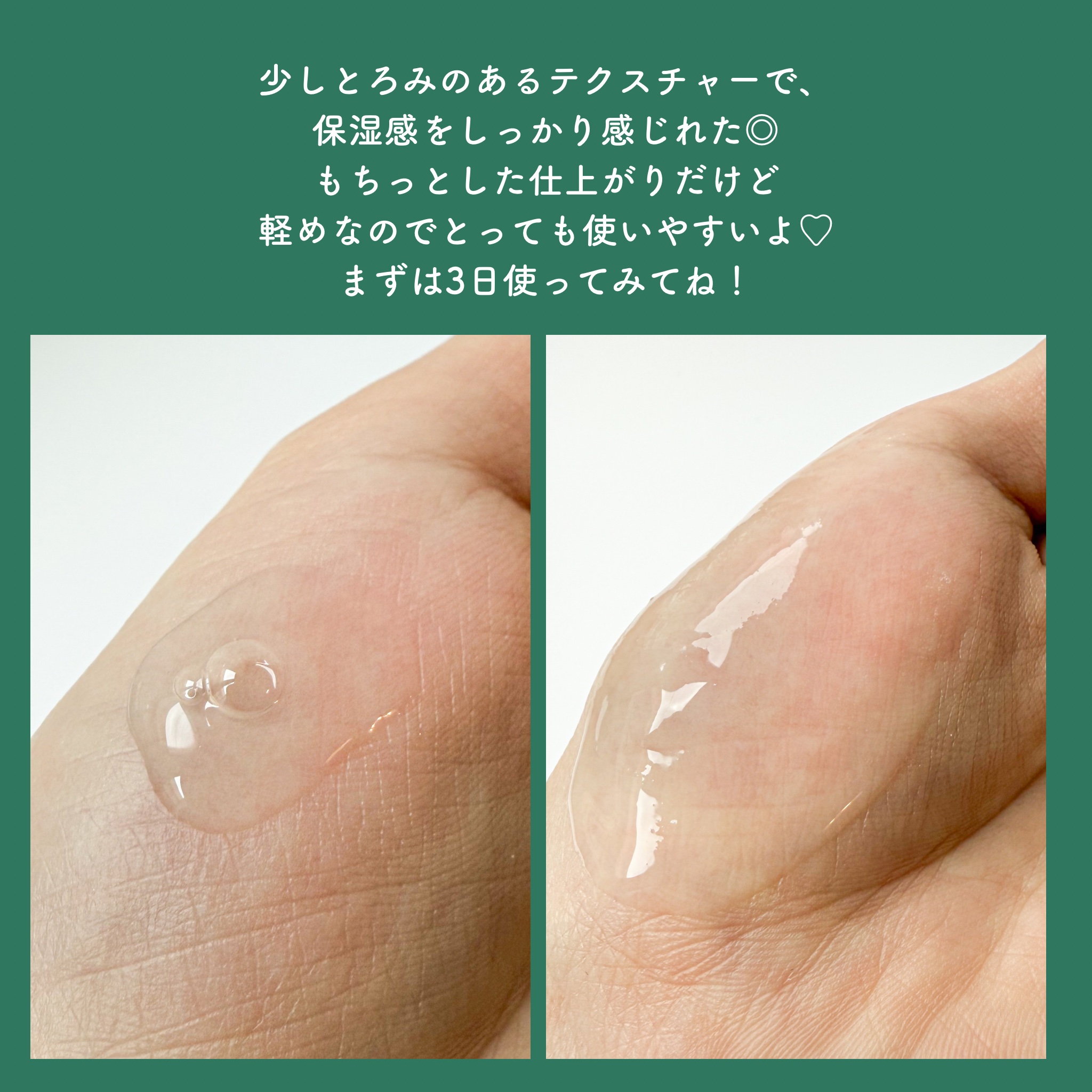 ジンクテカＢセラム/BRING GREEN/美容液を使ったクチコミ（3枚目）