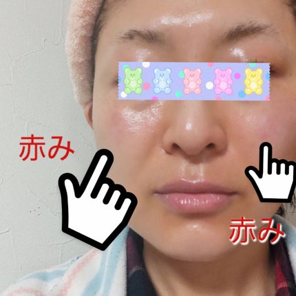 スーパーリンクルセラムVA/KISO/美容液を使ったクチコミ(2枚目)