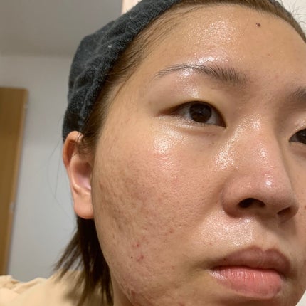 ドクダミ77 % 鎮静マスクパック/Anua/シートマスク・パックを使ったクチコミ(6枚目)