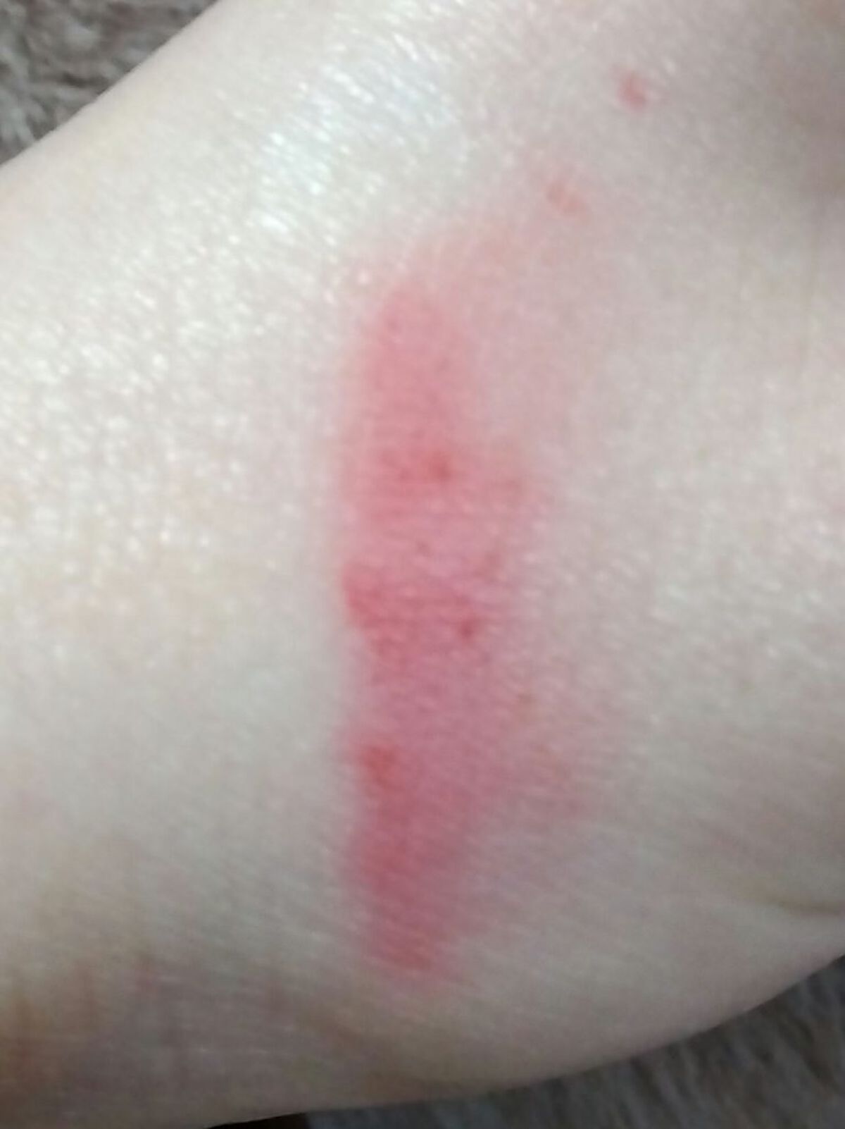 フィクシングティント/ETUDE/リップティントを使ったクチコミ（3枚目）