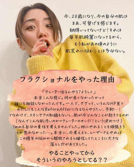 おゆみ|ニキビ・ニキビ跡ケア on LIPS 「【しくじり先生②早まるな、肌爆撃!💣】こんばんは、おゆみです💁..」(9枚目)