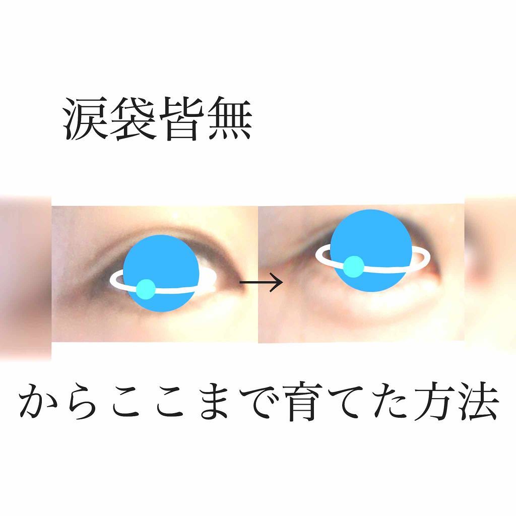 あずきのチカラ 目もと用/桐灰化学/その他を使ったクチコミ(1枚目)