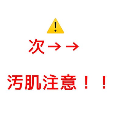 【すっぴん綺麗だね‼️いいえ、作ってます】

＿＿＿＿＿＿＿＿＿＿＿＿＿＿＿＿＿＿＿＿

#ウルミナプラス
#生つや肌おしろい乳液
ナチュラルベージュ
　　　SPF50+  PA++++


【色味】
明るいベージュに、ほんのりピンク
つやオーロラパールinでくすみをとばして
明るくふんわりとしたツヤ肌に✨


【カバー力】
毛穴とくすみに効果あり‼️
赤みとニキビ跡は隠せませんでした💦
ちょっとお出かけするくらいなら
こちらだけでいいと思います🙆🏼‍♀️💕


【化粧モチ】
皮脂さらさらパウダーで、テカリを抑えて
崩れとマスク移りを防止‼️

崩れにくいのに石鹸で落とせるから、
肌への負担も少ないです🙆🏼‍♀️💕


【保湿力】
ヒアルロン酸、コラーゲン、アルガンオイル
ハトムギエキスなどの保湿成分が入っていて
乾燥せず、しっとりした仕上がり‼️

ですが、パウダーinなので乾燥肌の方は
乾燥するかも…


【匂い】
爽やかで透明感のある
クリアフローラルの香り

天然香料を使用していて、変な甘ったるさが
なくて、マスクの中でもいい匂い〜🍀
匂いがわりと長く続くので、苦手な人もいるかな…💦

＿＿＿＿＿＿＿＿＿＿＿＿＿＿＿＿＿＿＿＿

【総まとめ】
とにかく毛穴カバー力がすごかった‼️
自然に肌を明るくしてくれて
透明感のある生ツヤ肌になれました✨

乾燥する冬にも、紫外線やテカリが気になる
夏にも使えるおしろい乳液です🧴💕


ただ、寝不足だったのか、少しだけ痒みが
出てしまいました…🥺💦
新しいコスメを使うと、体調によってすぐ肌に出るので、あまり参考になりませんが…
これがなかったら星6こ付けたいくらい気に入りました‼️

#おしろい乳液　#ツヤ肌　#毛穴カバー　#肌のくすみ  #ガチレビュー #提供_ウルミナプラスの画像 その2