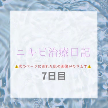 【7日目】

まーーじでおちついた！！！最高！！
黒さと赤みが残るけど、汁も腫れもないです！！！！唇はなんか知らんけど皮が向けます！！！保湿の鬼になって保湿しまくってます。
治療前のブチブチは少し残って