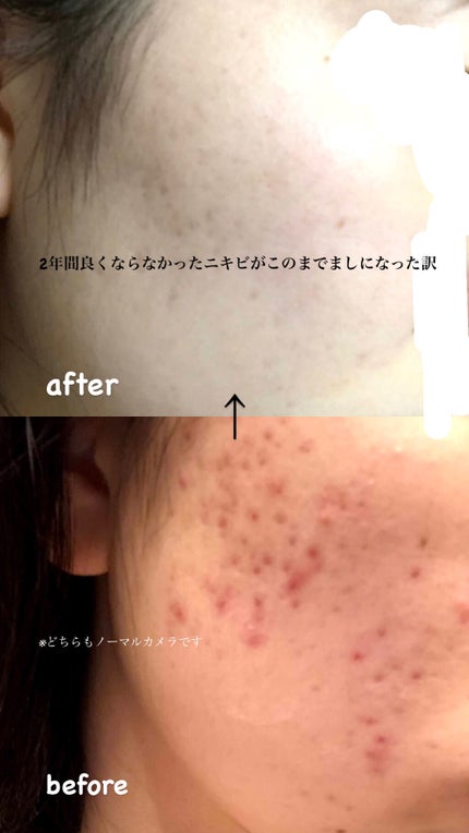 化粧水・敏感肌用・高保湿タイプ/無印良品/化粧水を使ったクチコミ(1枚目)