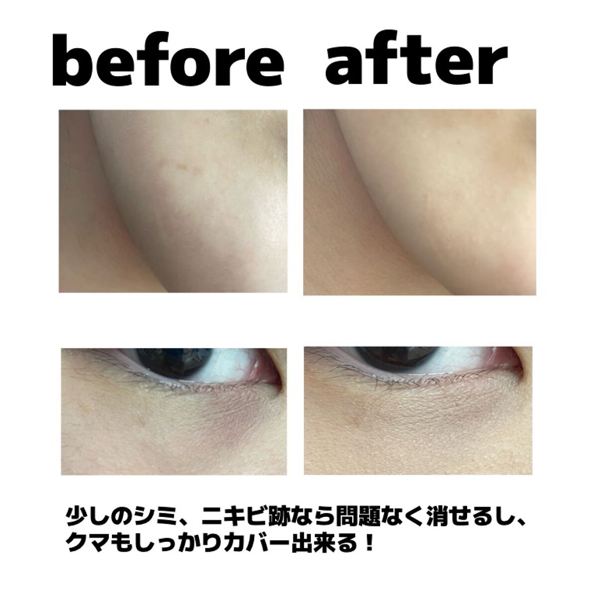 ダーマシンコンシーラー/23years old/リキッドコンシーラーを使ったクチコミ(2枚目)