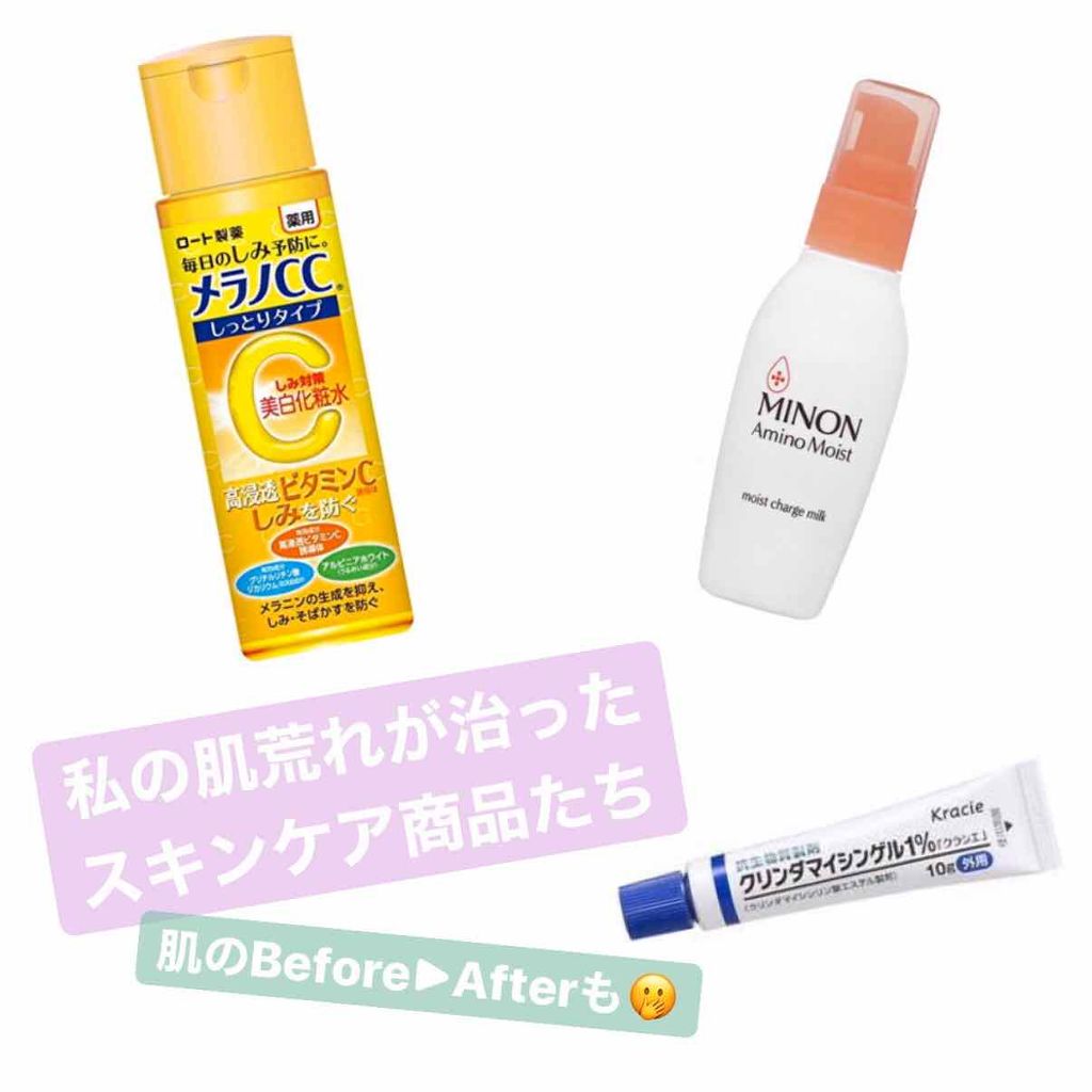 ミノン アミノモイスト モイストチャージ ミルク/ミノン/乳液を使ったクチコミ（1枚目）