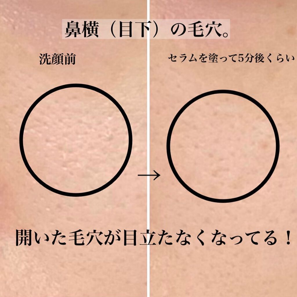 ゼロ毛穴1DAYセラム/MEDICUBE/美容液を使ったクチコミ(4枚目)