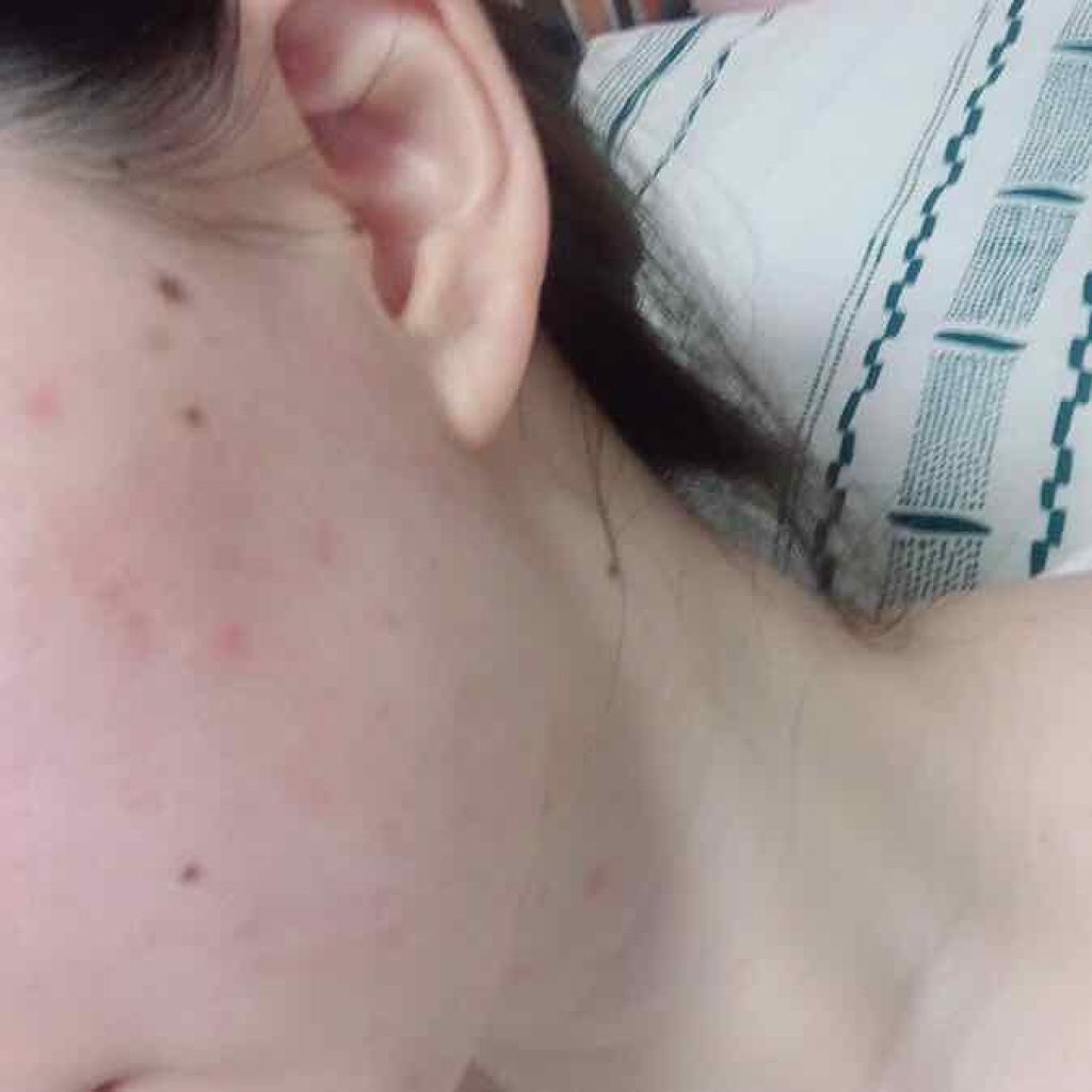 マイクロセッティングフィットEX SPF50+PA++++ Micro setting fit Cushion EX/moonshot/クッションファンデーションを使ったクチコミ(2枚目)