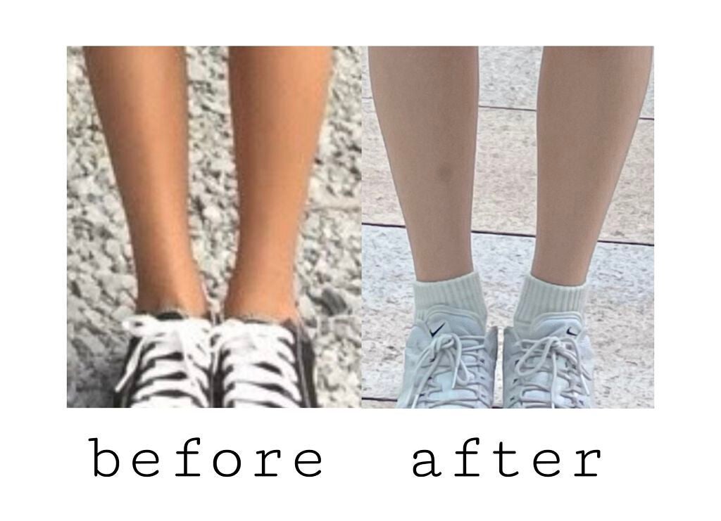 ハトムギ化粧水(ナチュリエ スキンコンディショナー R )/ナチュリエ/化粧水を使ったクチコミ(2枚目)