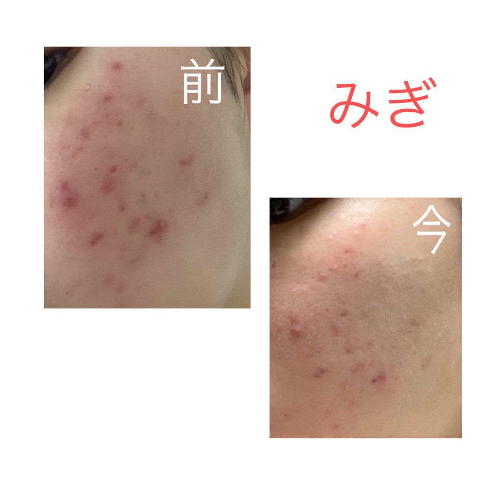 ハトムギ化粧水(ナチュリエ スキンコンディショナー R )/ナチュリエ/化粧水を使ったクチコミ（3枚目）