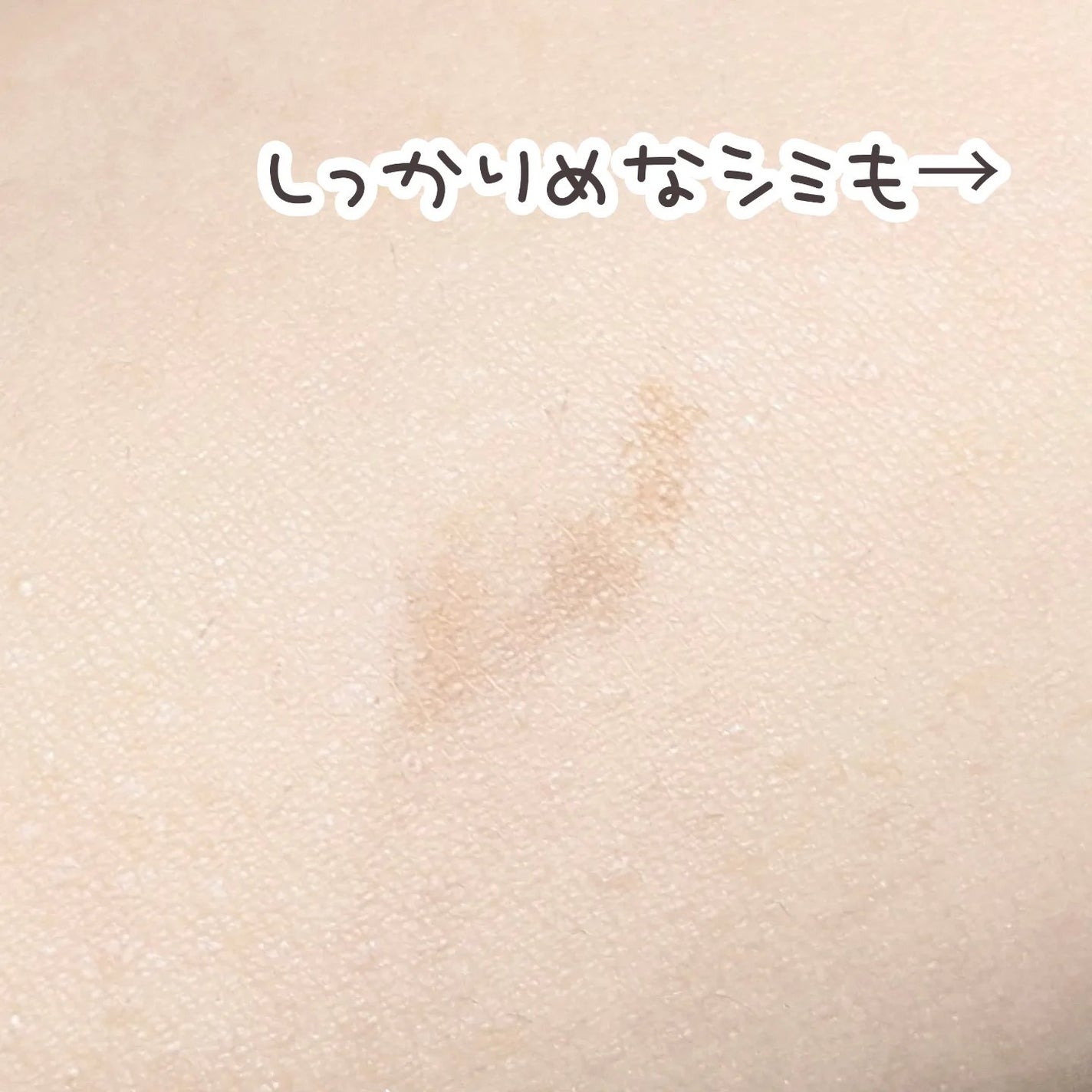 ダーマシンコンシーラー/23years old/リキッドコンシーラーを使ったクチコミ(3枚目)