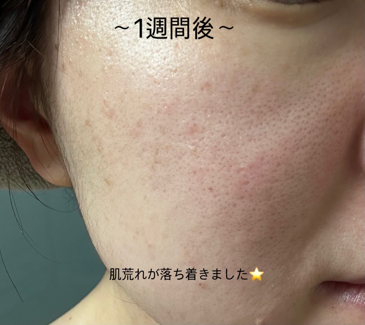 レチノール スーパーバウンス セラム/IOPE/美容液を使ったクチコミ(4枚目)