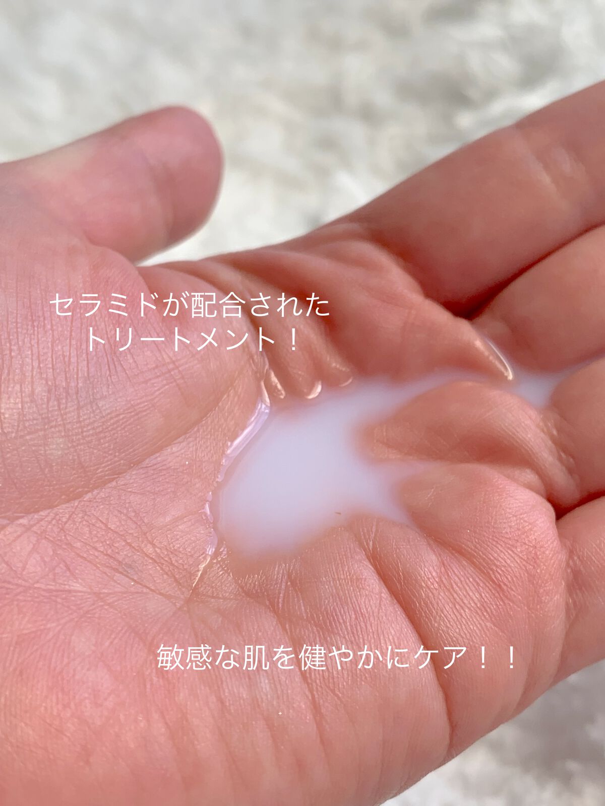 CERAPYome Moist In Treatment/my skin solus/美容液を使ったクチコミ（3枚目）