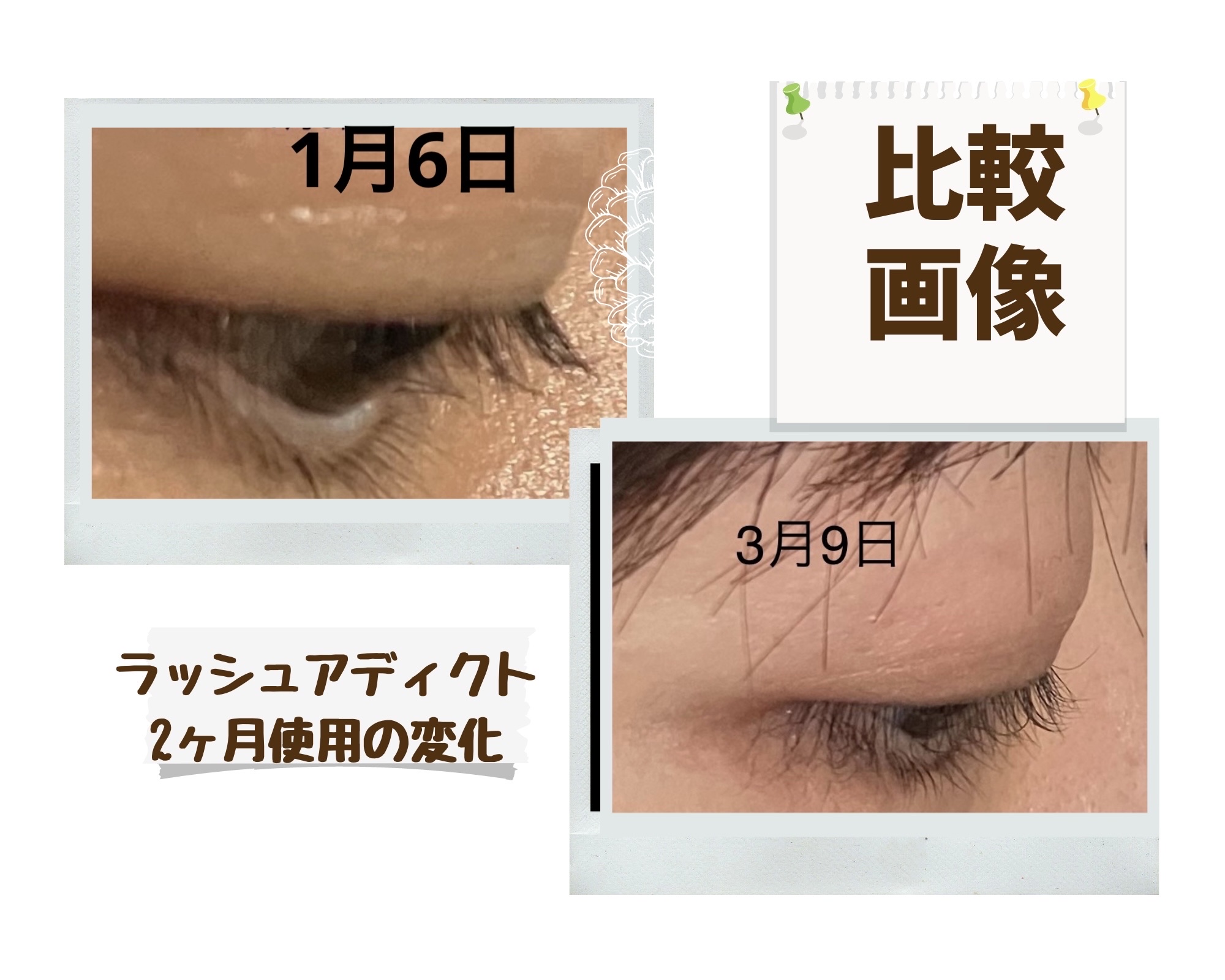 スカルプD ボーテ ピュアフリーアイラッシュセラム　プレミアム/アンファー(スカルプD)/まつげ美容液を使ったクチコミ（3枚目）