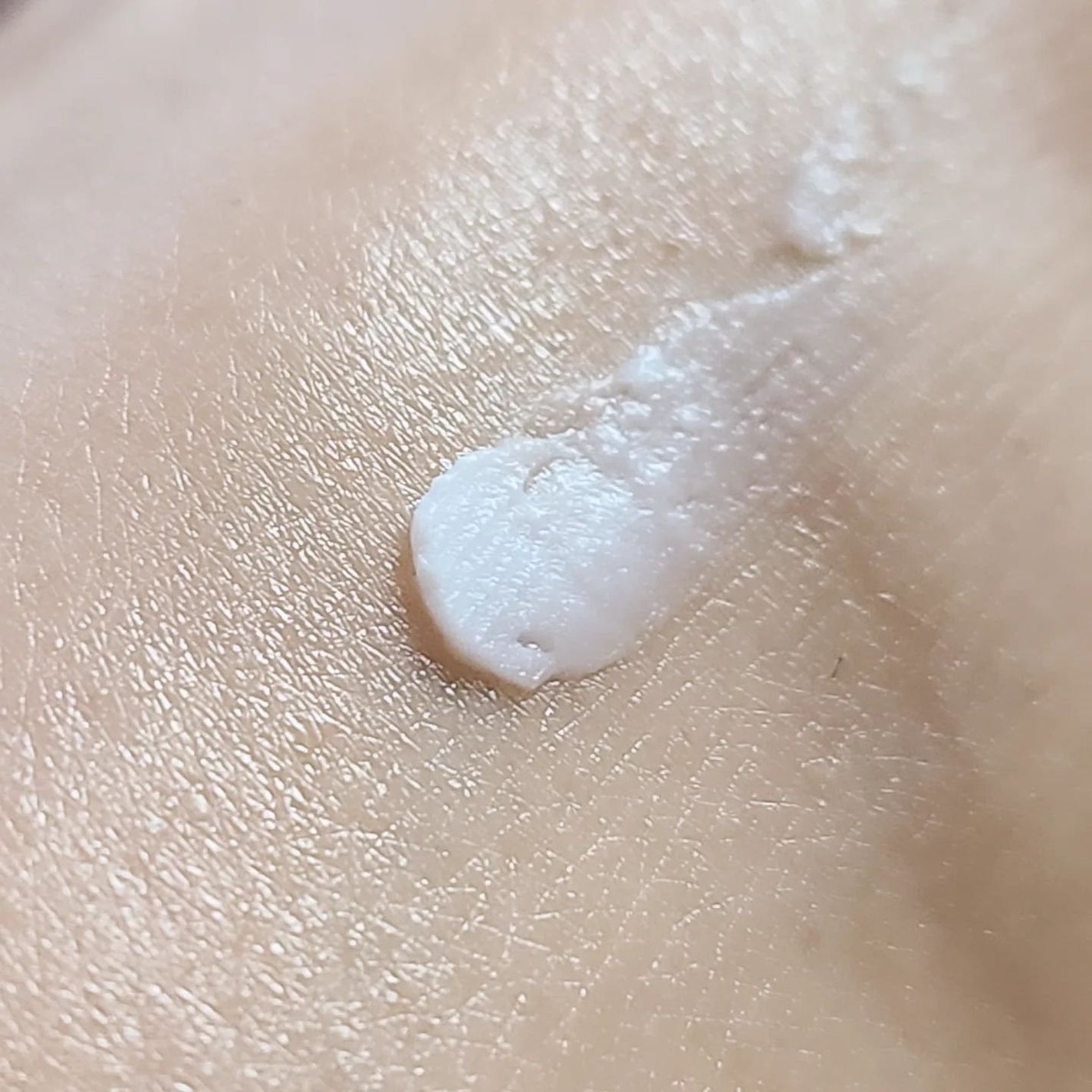 リンクルショット メディカル セラム N/リンクルショット/アイケア・アイクリームを使ったクチコミ(6枚目)