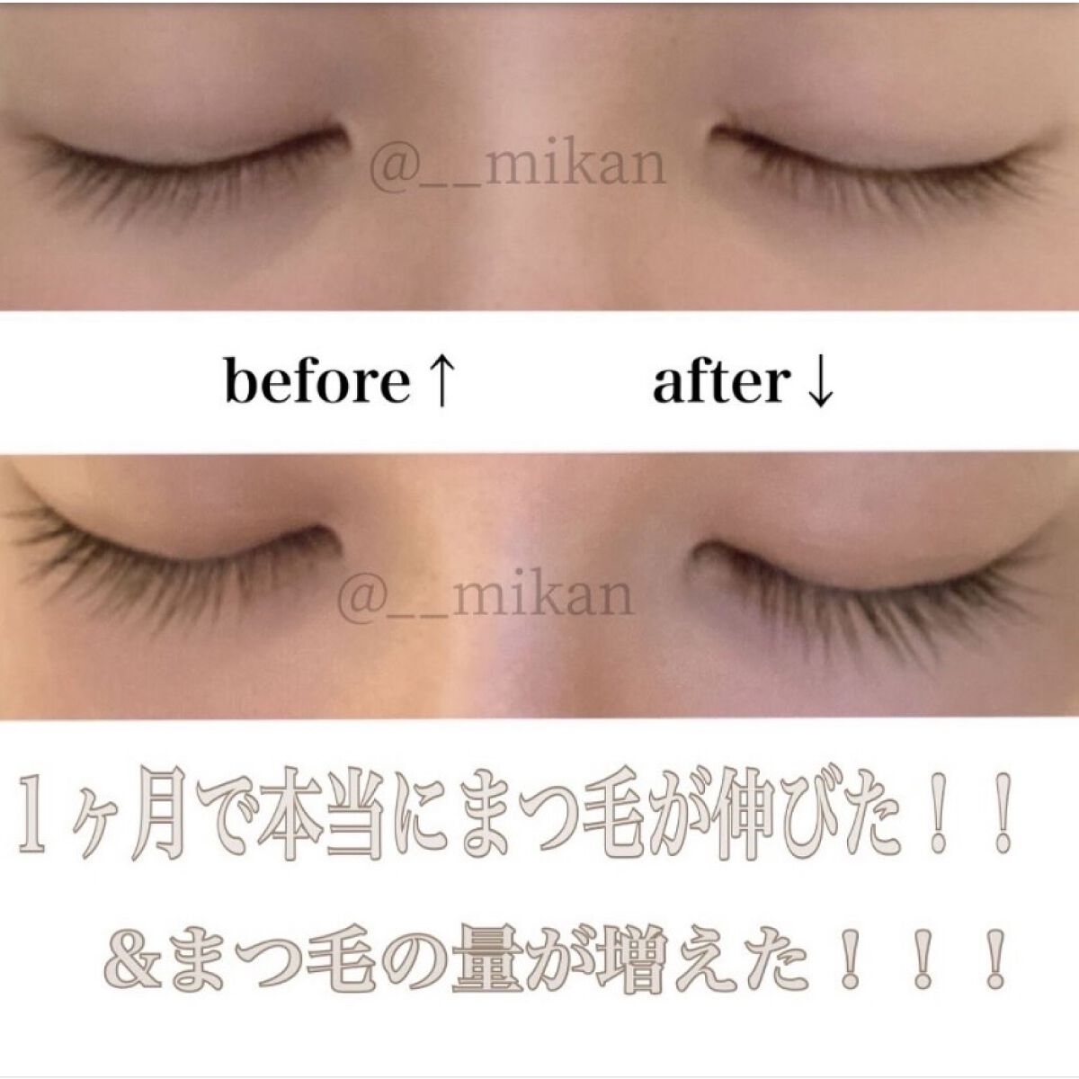 #EMAKED 高いだけの効果あり！！！
まつ育したいなら絶対試すべき！

１ヶ月毎日使い続けたらこんなに伸びました！
長さはもちろんですが、量もかなり増えているのが写真でも分かりますね☺️

こんなにまつ毛伸びたことがうれしーーい😭

