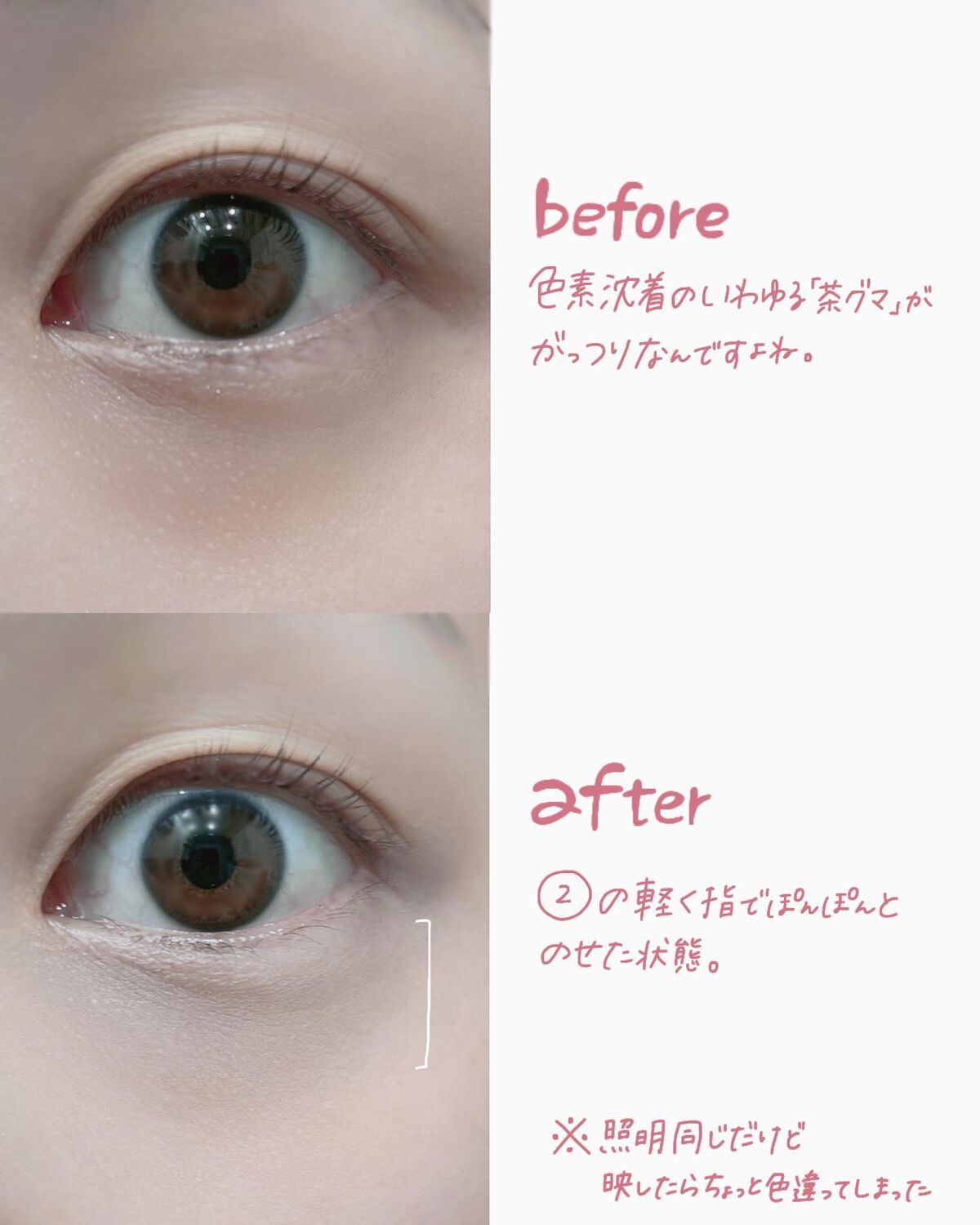 トーンパーフェクティング パレット/DECORTÉ/パレットコンシーラーを使ったクチコミ(7枚目)