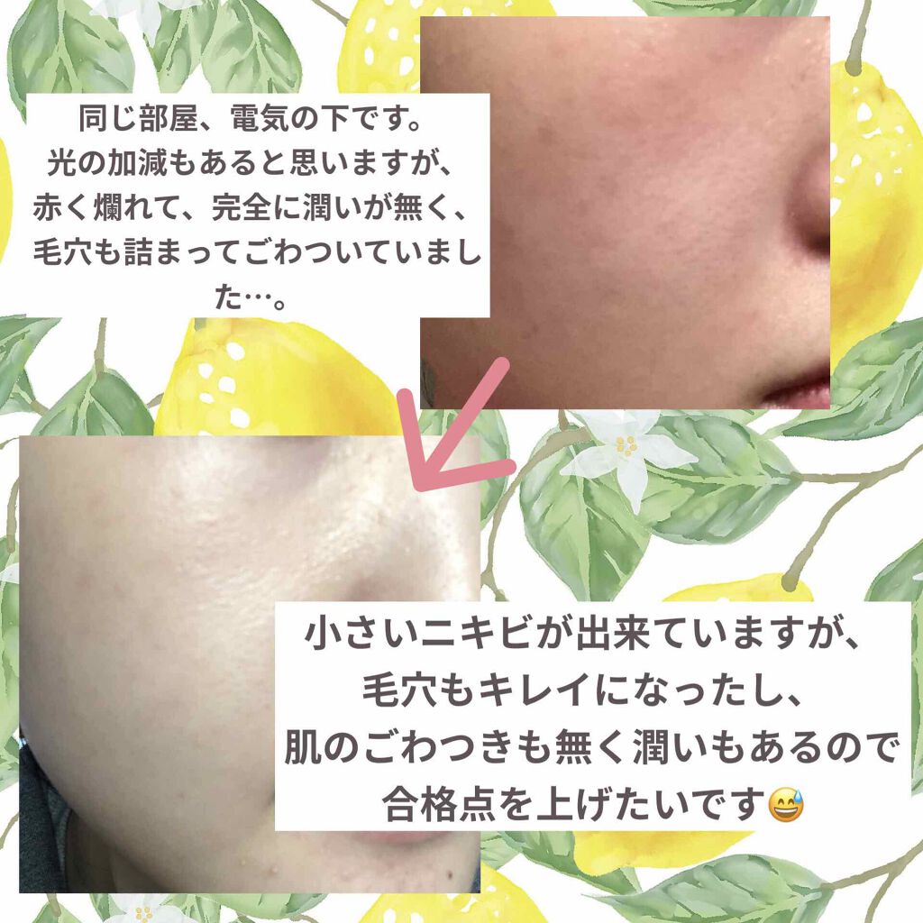 アルガンオイル/エトヴォス/フェイスオイルを使ったクチコミ（2枚目）