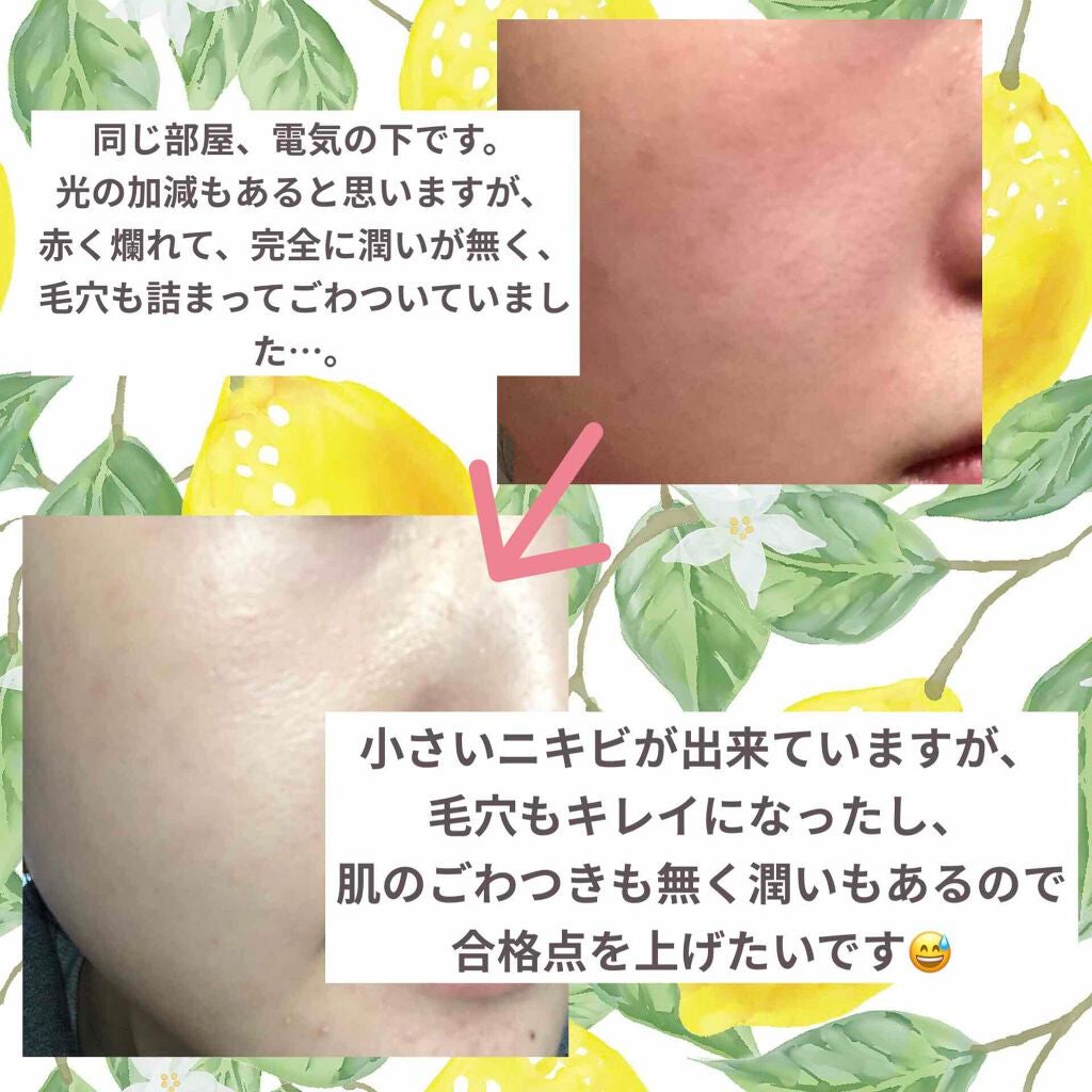 モイスチャライジングセラム/エトヴォス/美容液を使ったクチコミ(2枚目)