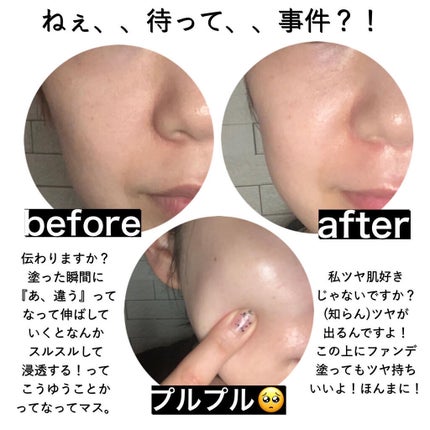 ウォータリッシュベーシスアンプル/MINT FACTORY/美容液を使ったクチコミ(6枚目)