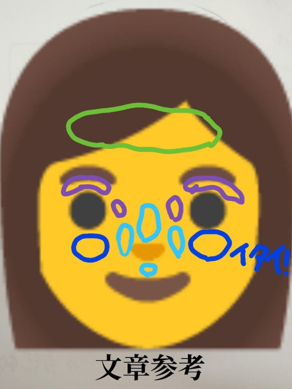 薬用リップスティックXD/メンソレータム/リップクリームを使ったクチコミ(2枚目)