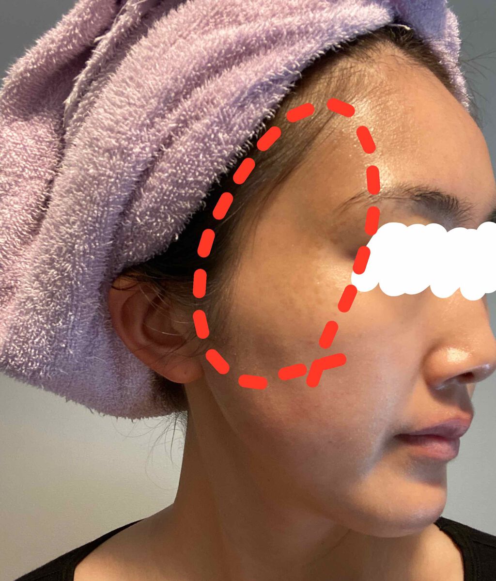 ブラン エクスペール クッションコンパクト L n/LANCOME/クッションファンデーションを使ったクチコミ(1枚目)