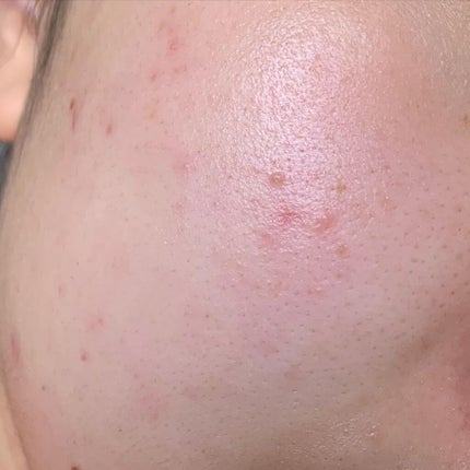 Q10アンチリンクルフェイスクリーム/Eucerin/フェイスクリームを使ったクチコミ(3枚目)