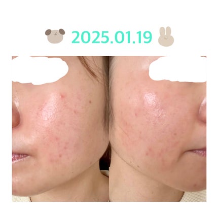 を使ったクチコミ(1枚目)