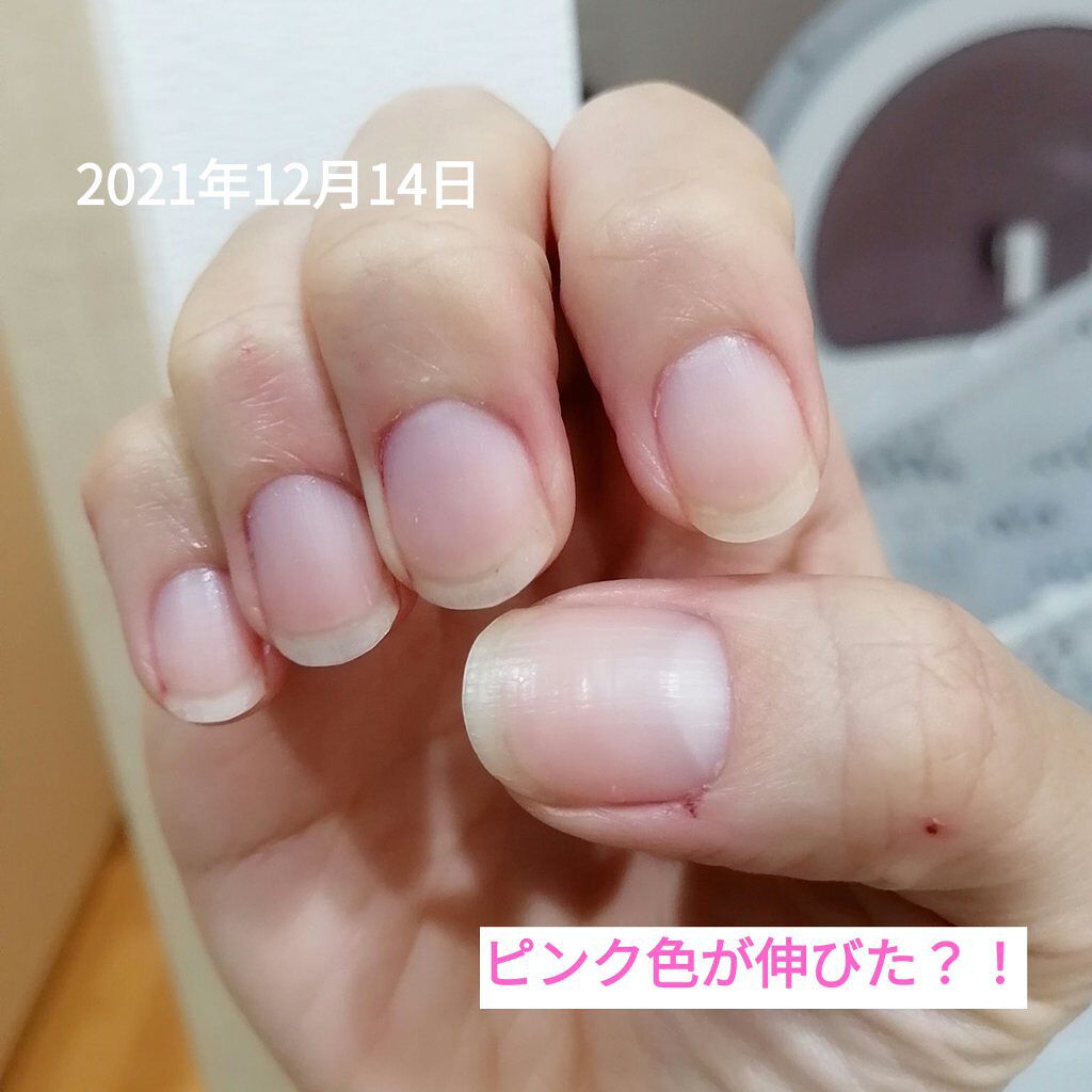 キューティクルネイルオイル ペンタイプ No Nail No Lifeの口コミ 育爪 ハイポニキウム記録 2枚目be By なつめぐnail 30代前半 Lips キューティクルネイルオイル ペンタイプ No Nail No Lifeの口コミ 育爪 ハイポニキウム記録 2枚目be By なつめぐnail 30代前半 Lips