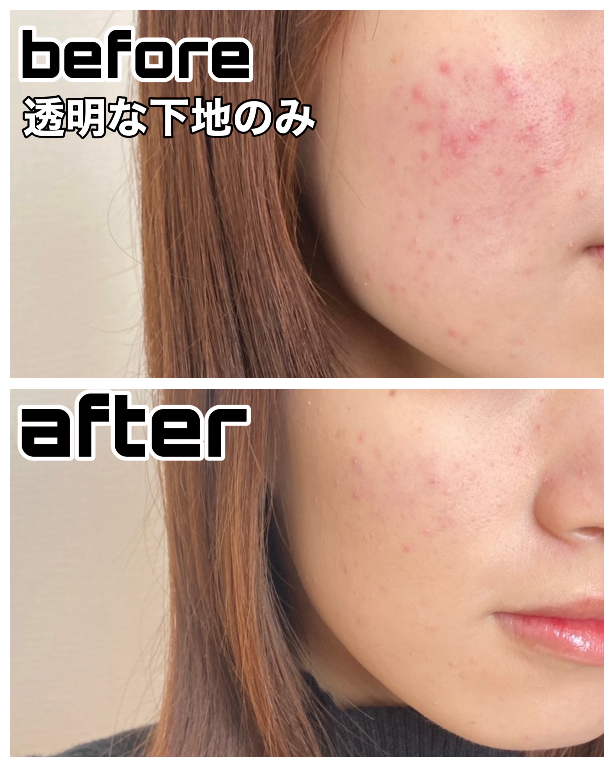 GIVENCHY プリズム･リーブル･グロウ･セラム･ ファンデーションのクチコミ「肌は加工なしで載せています。色味や質感が分かりやすいようにしているので、ご参考になれば嬉しいで.....」（3枚目）