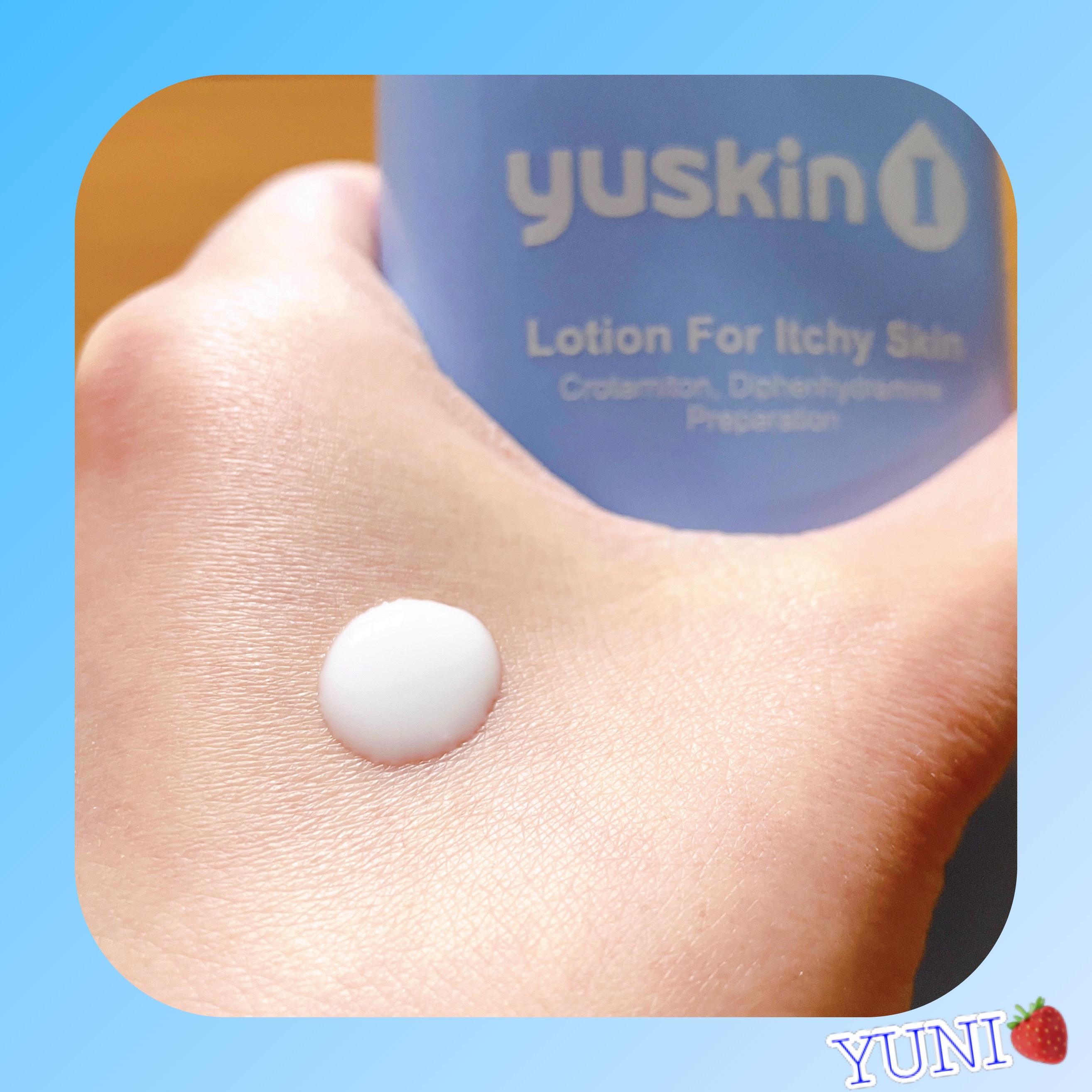 ユースキンIローション（医薬品）/ユースキンI(アイ)/その他を使ったクチコミ（2枚目）