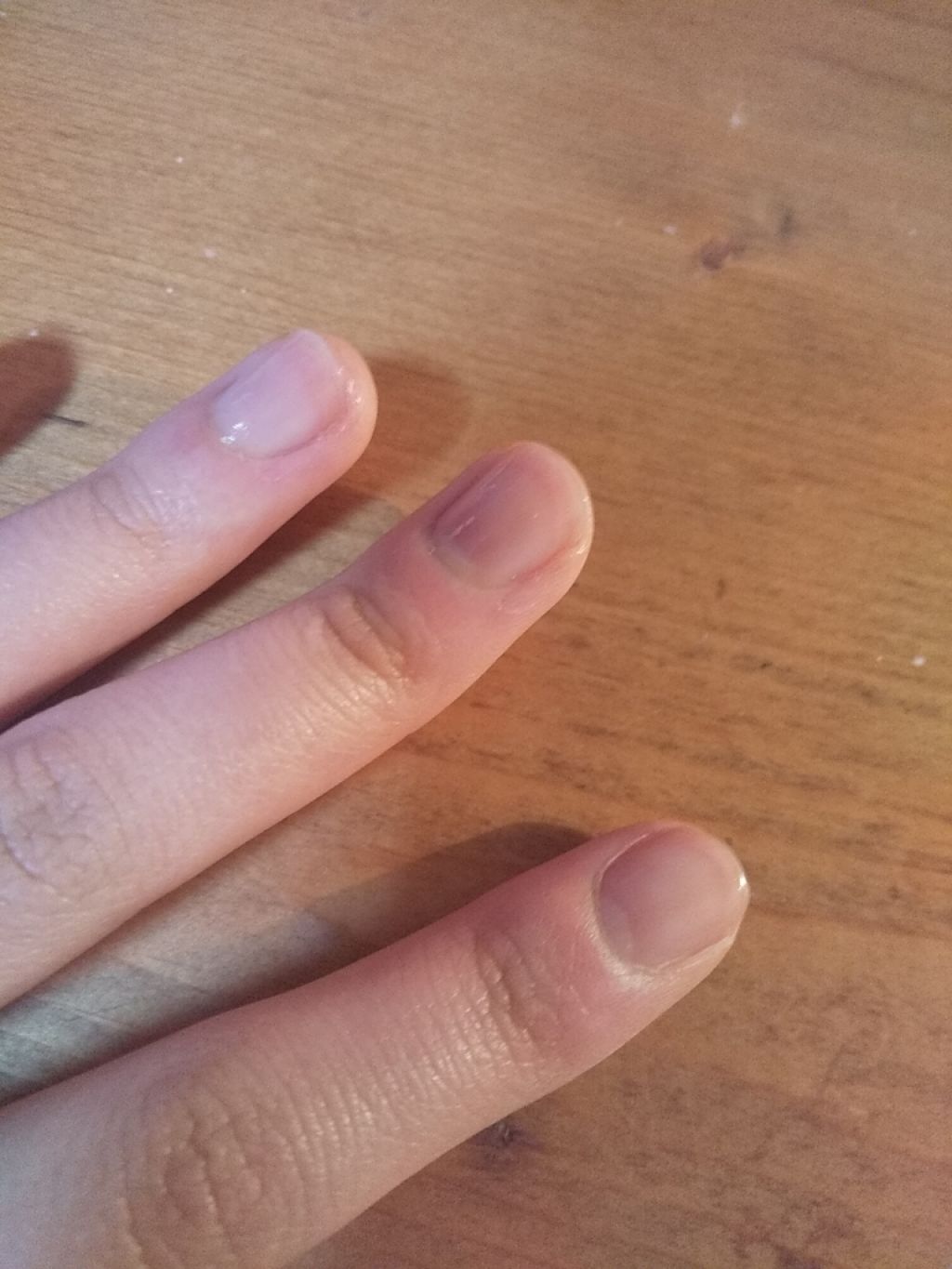 シェイクネイルケアオイル/スキューズミー/ネイルオイル・トリートメントを使ったクチコミ（3枚目）