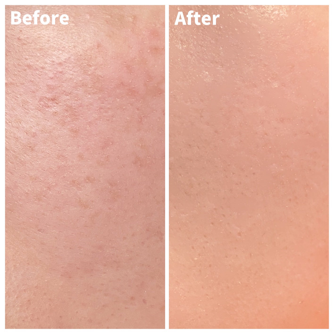 ピンクティーツリーカバークッション/APLIN/クッションファンデーションを使ったクチコミ(6枚目)