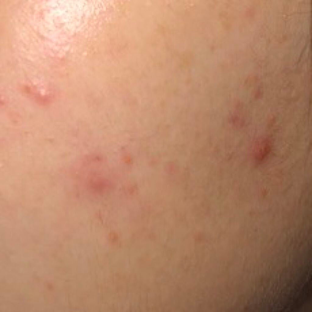 明色美顔水 薬用化粧水/美顔/化粧水を使ったクチコミ(2枚目)