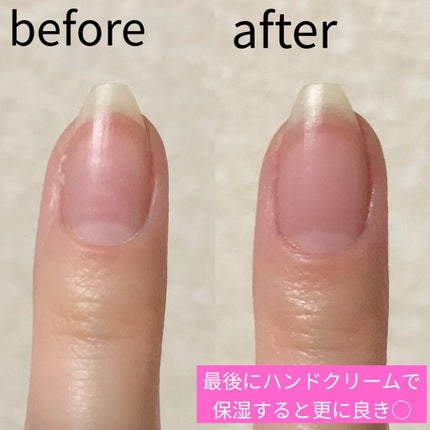 ネイル美容液 保湿オイル/COSCELIA/ネイルオイル・トリートメントを使ったクチコミ(3枚目)