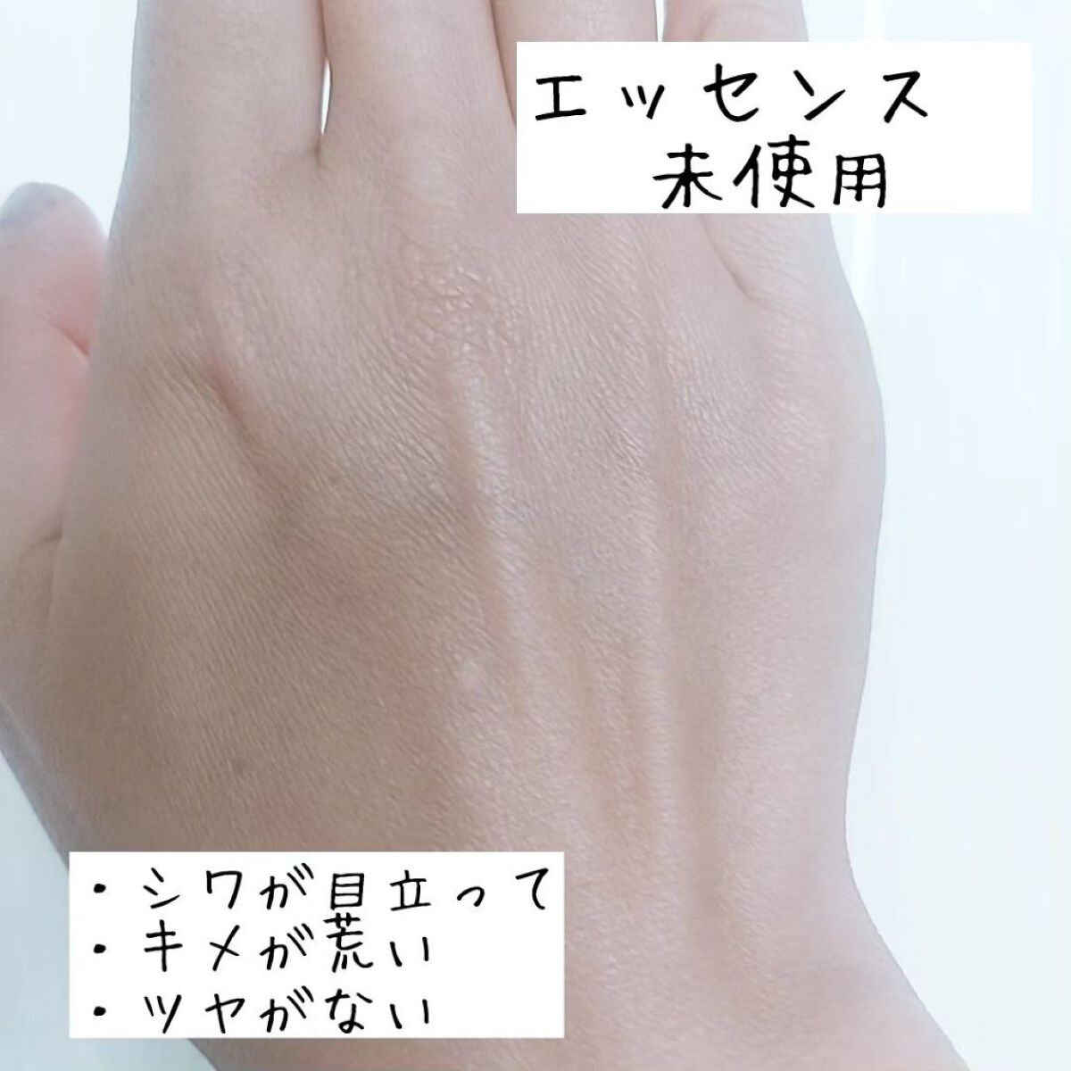 アドバンスド スネイル96 ムチンパワーエッセンス/COSRX/美容液を使ったクチコミ（3枚目）