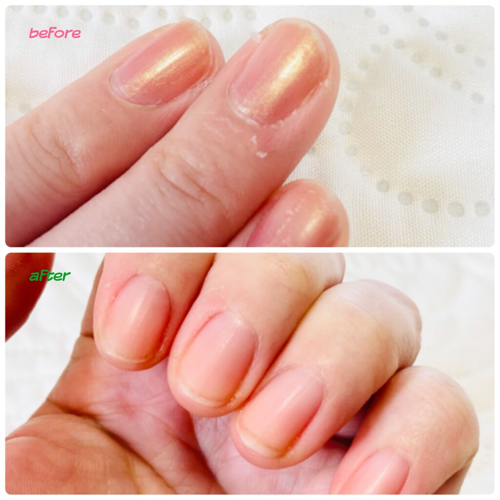 ニーナニーナジェルネイルリムーバー/DAISO/除光液を使ったクチコミ（2枚目）