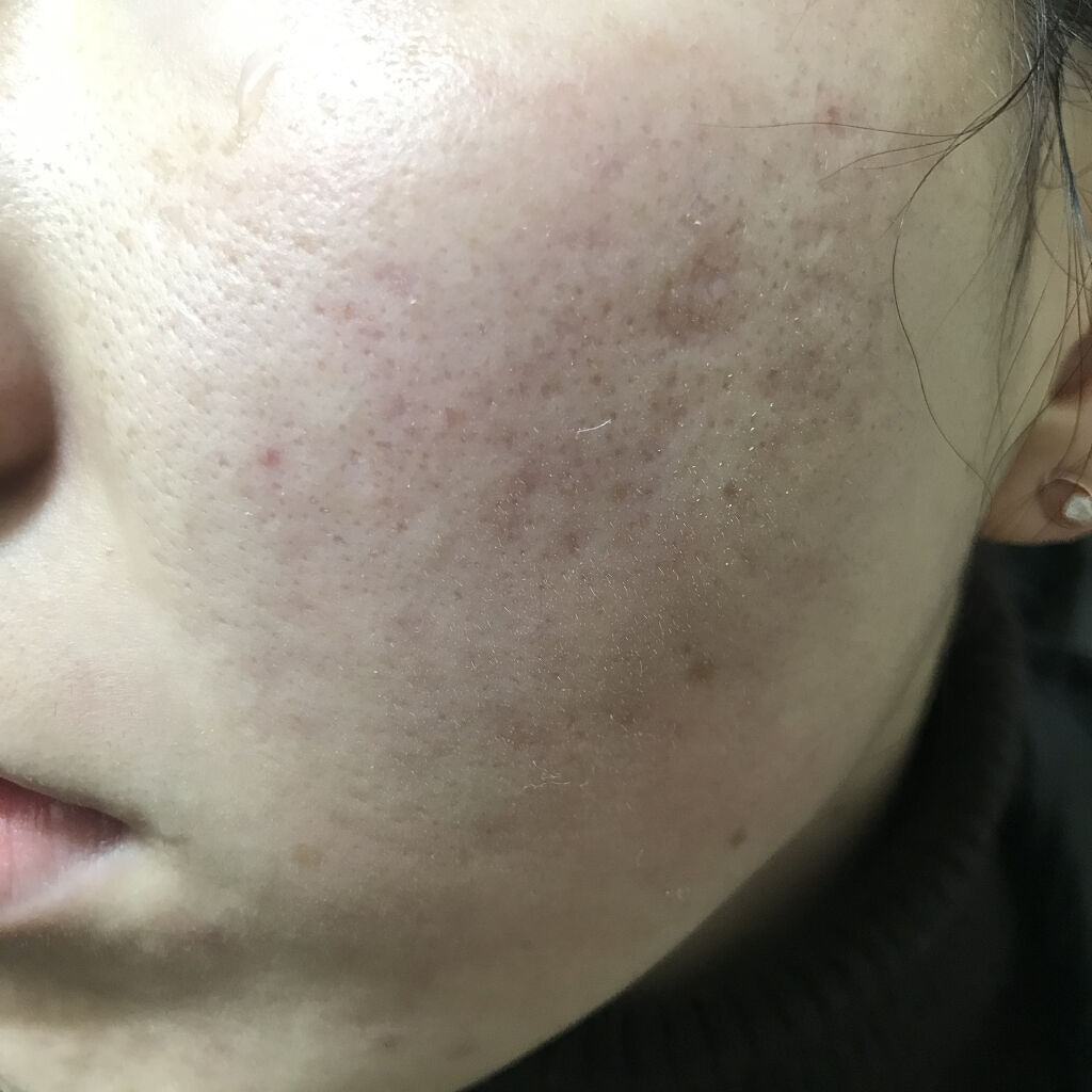 ドクタージャルト シカペア リカバー (第2世代）/Dr.Jart＋/フェイスクリームを使ったクチコミ（2枚目）