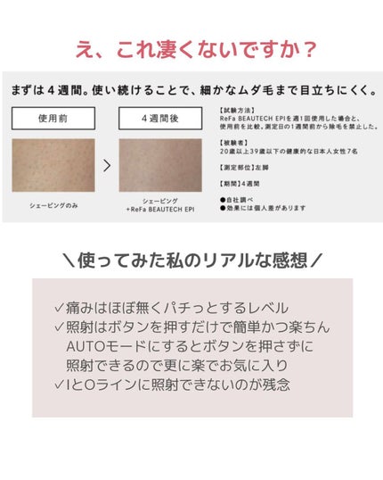 リファ ビューテックエピ/ReFa/家庭用脱毛器を使ったクチコミ(5枚目)