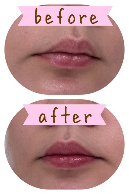 ルージュスターヴァイブラント/KANEBO/口紅を使ったクチコミ(3枚目)