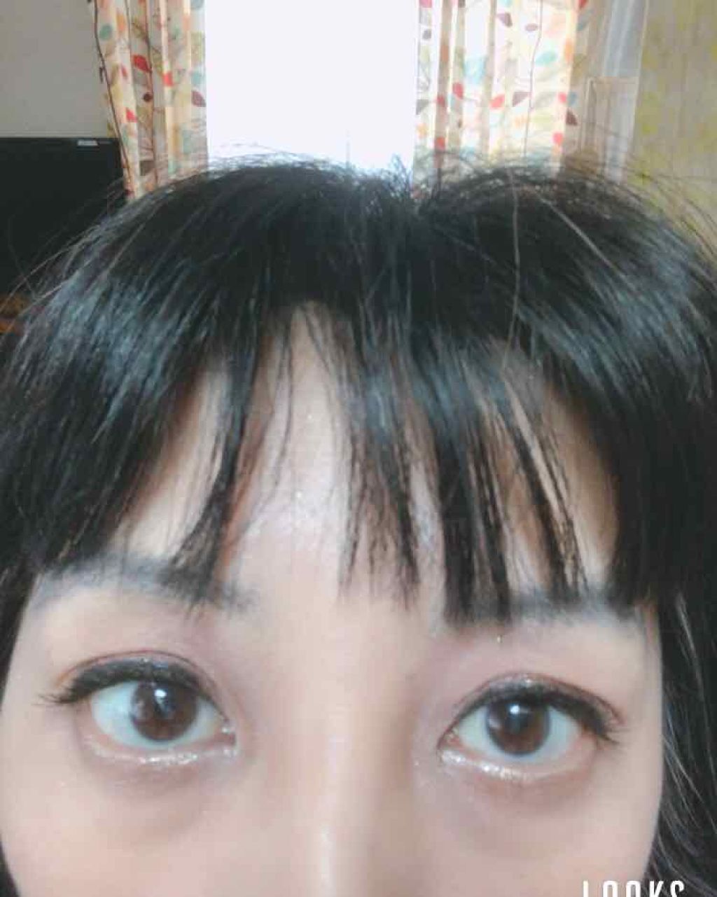 バイオイル/バイオイル/フェイスオイルを使ったクチコミ（2枚目）