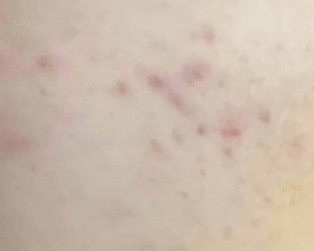 ハトムギ化粧水(ナチュリエ スキンコンディショナー R )/ナチュリエ/化粧水を使ったクチコミ(3枚目)