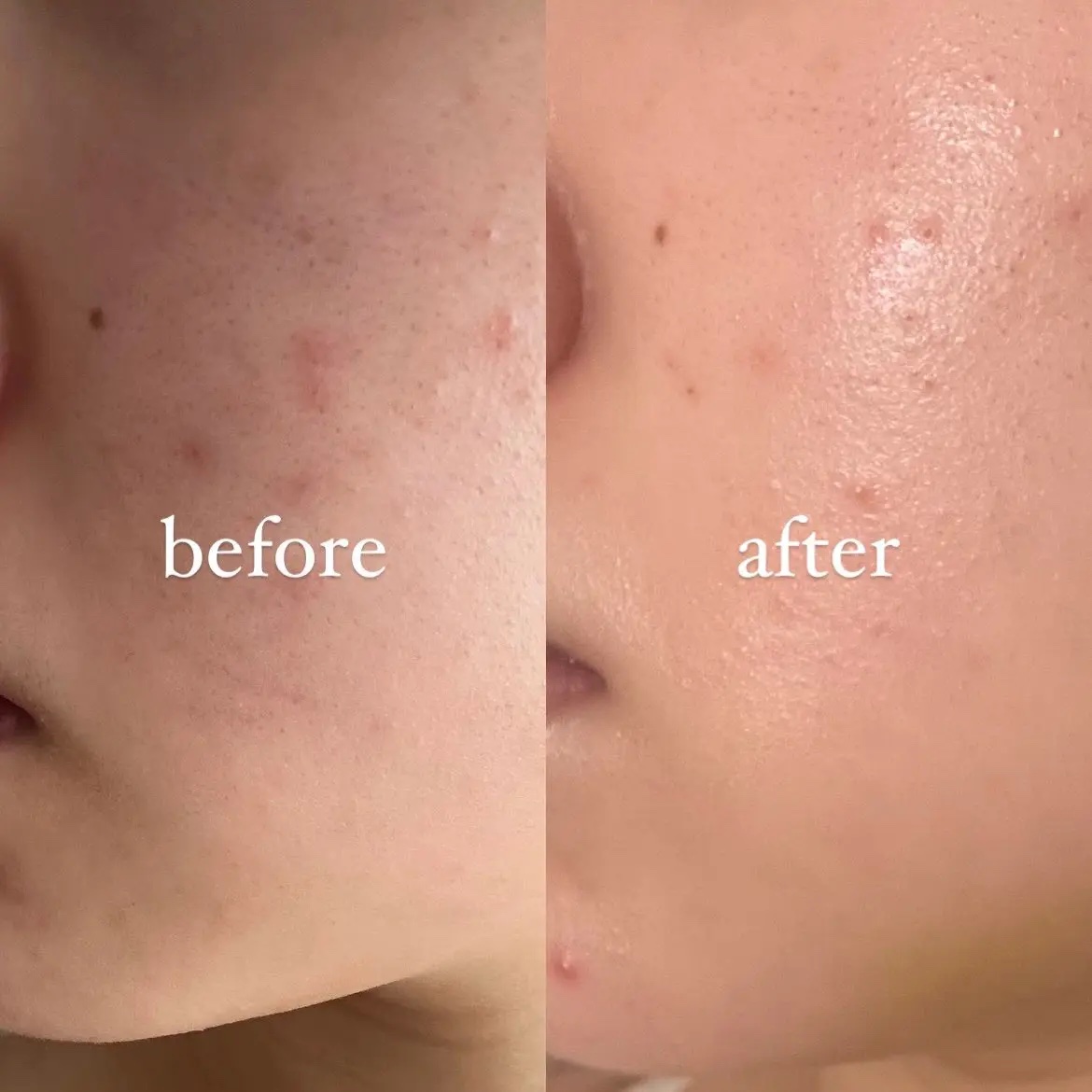 ブラックスネイル クリーム/Dr.G/フェイスクリームを使ったクチコミ（3枚目）