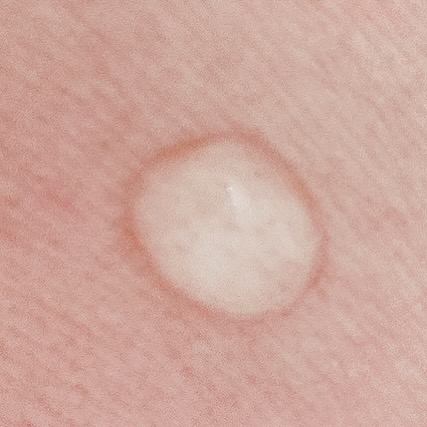 ドレススノー ローション【医薬部外品】 /アテニア/化粧水を使ったクチコミ（3枚目）