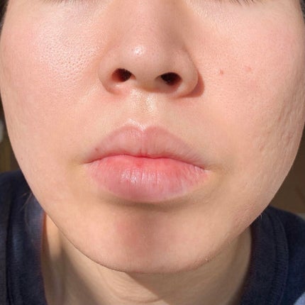 ガラクナイアシン2.0エッセンス/manyo/美容液を使ったクチコミ(5枚目)